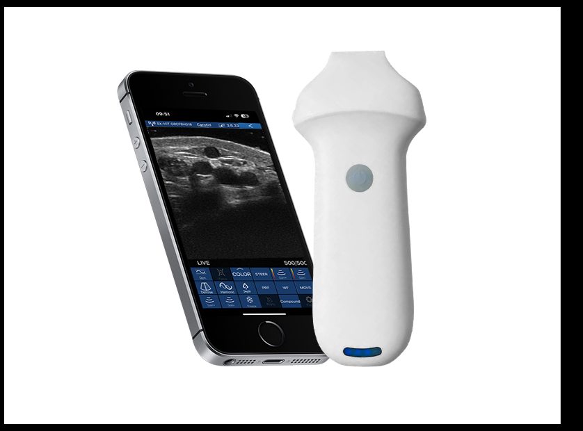 SonoStar VISION8 S — ολόκληρη κεφαλή και σύνδεση κινητού