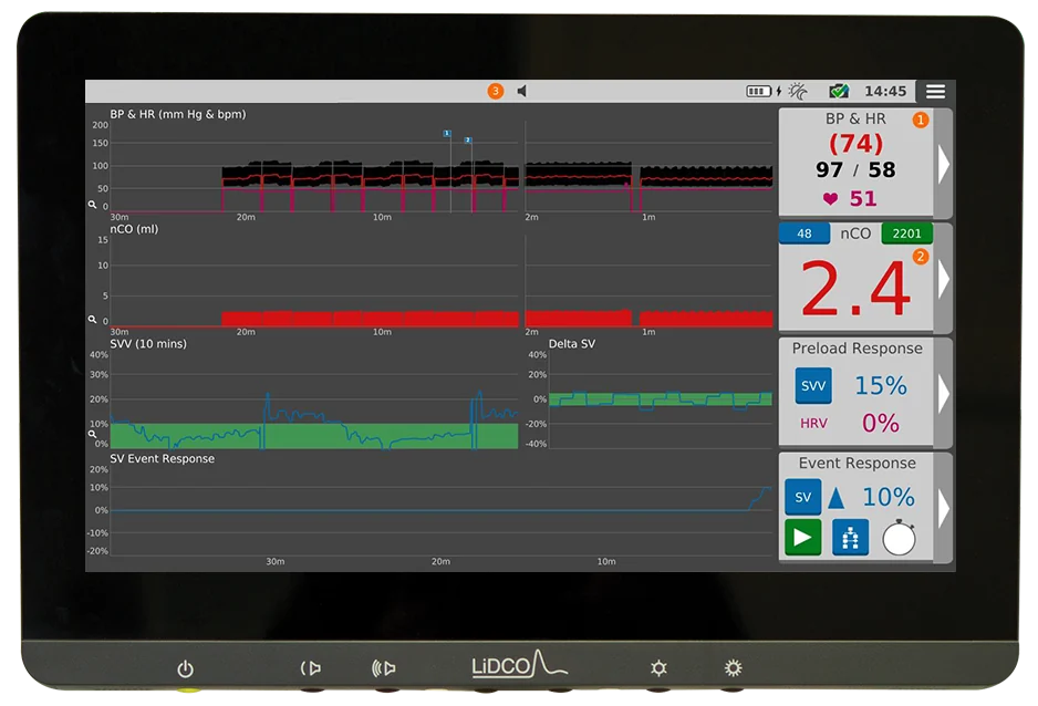 LiDCO Unity trend screen