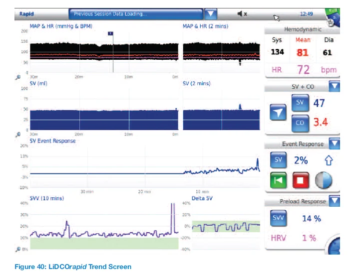 LiDCO Rapid trend screen