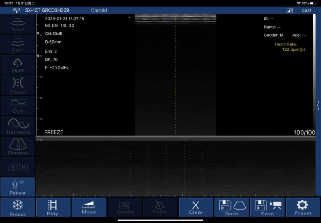 SonoStar M-Mode