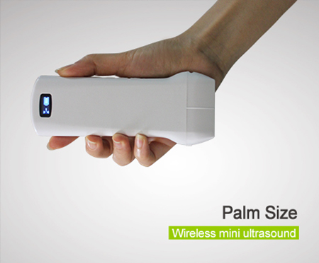 SonoStar wireless mini ultrasound