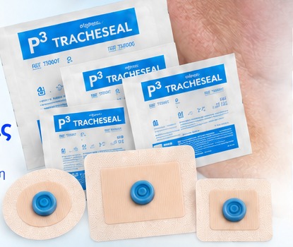 Tracheseal