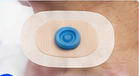 Tracheseal 3