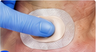 Tracheseal 6